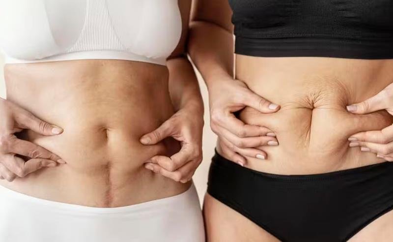 Dr. Octávio Curi Frascareli – Cirurgia da Mulher Moderna Pós-Gestação em Maringá: autoestima, firmeza e proporção